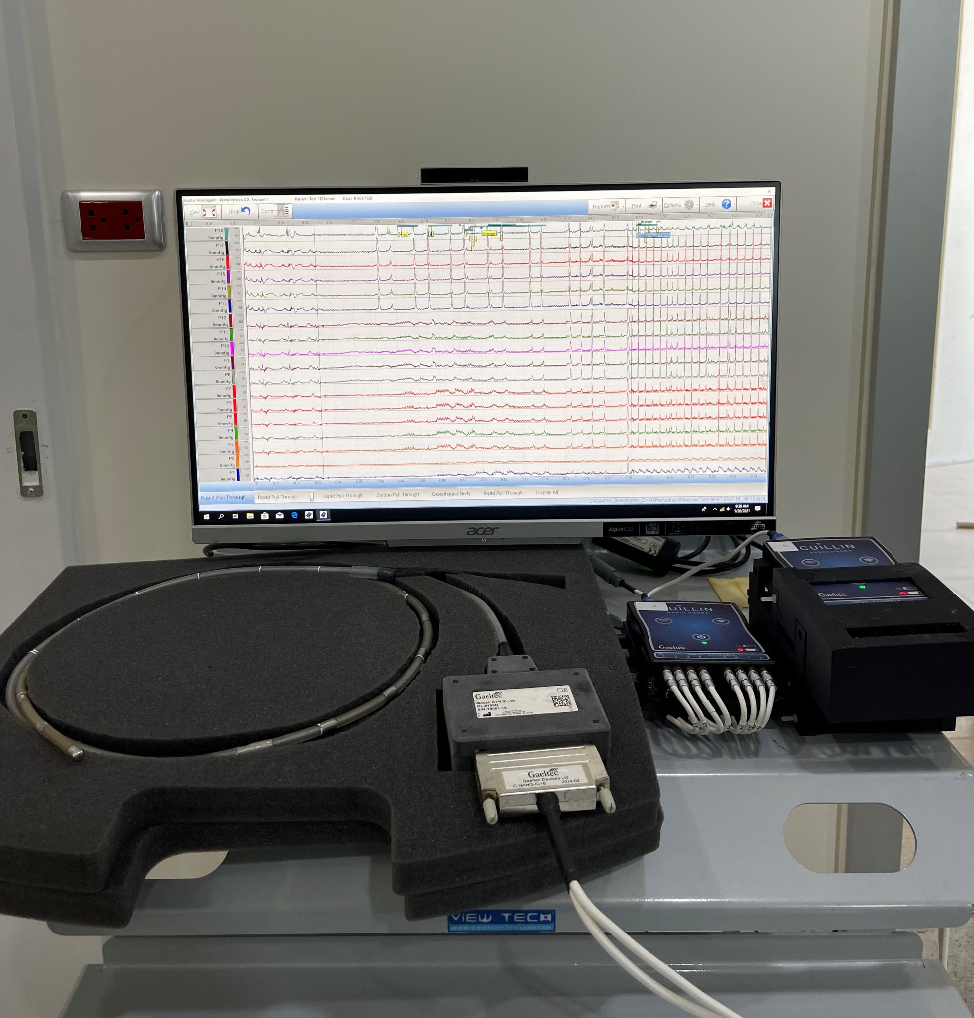 บริการ – CU-GI Motility